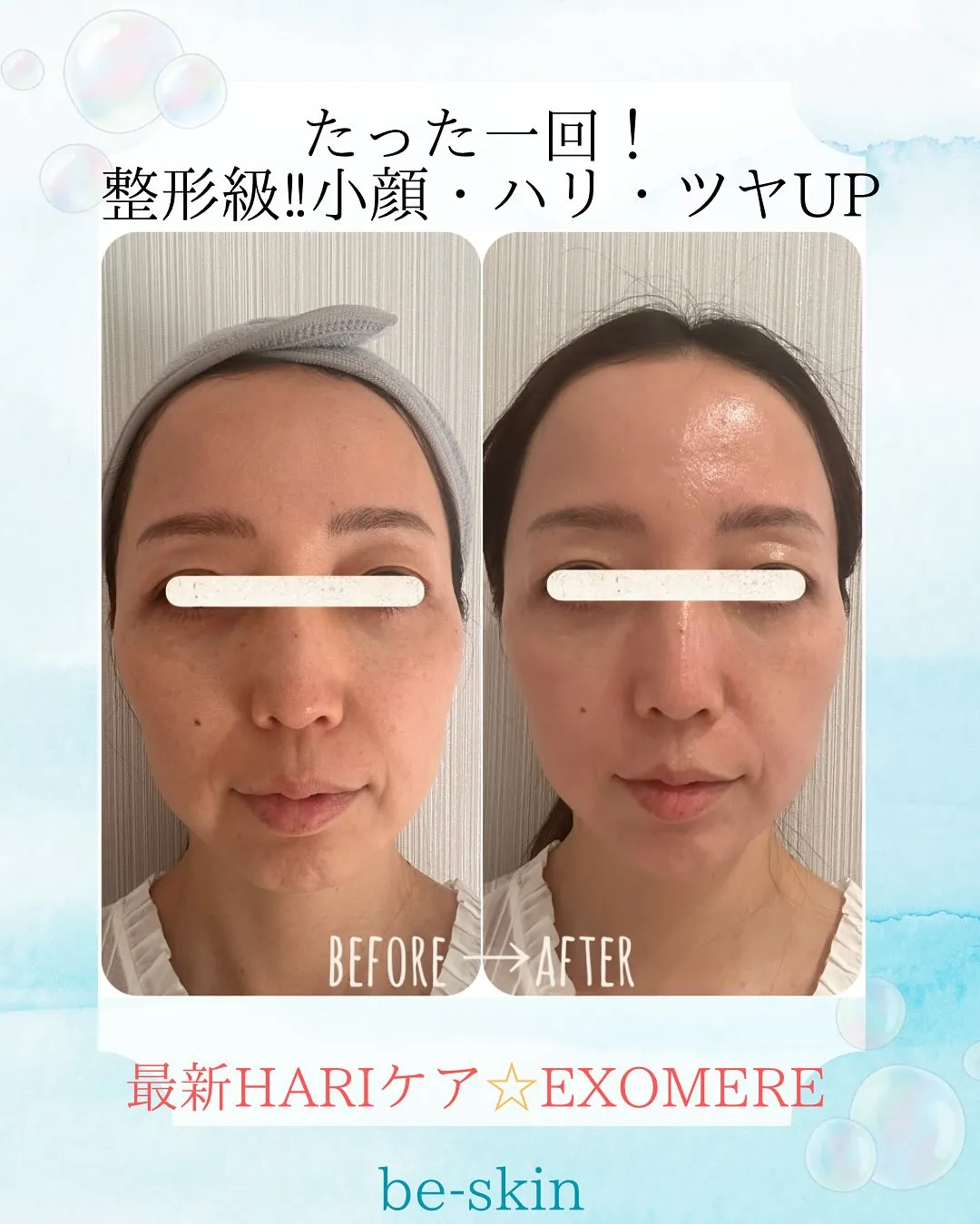 【沖縄初上陸】EXOMERE✨韓国最新ドクターズコスメ