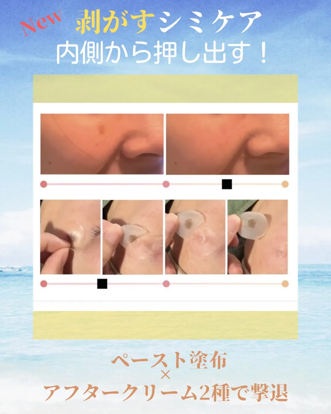 New!! 剥がす・内側から押し出すシミケア!